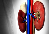 Best Nephrology hospital in raipur
