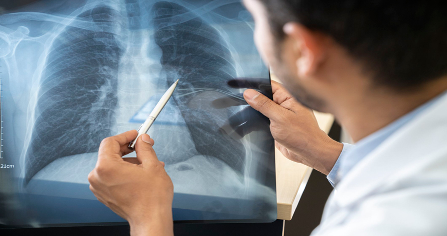 Best Pulmonology hospital in raipur