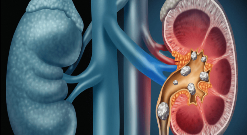 Best Urology hospital in raipur