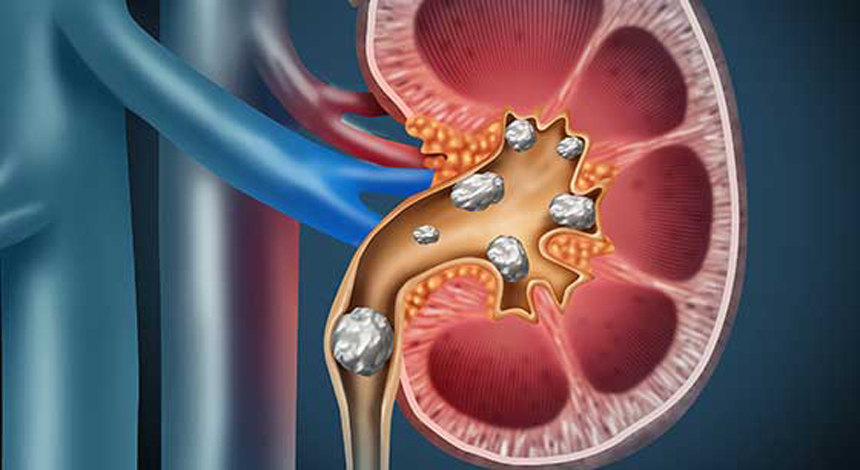 Best Urology hospital in raipur